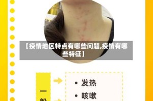 【疫情地区特点有哪些问题,疫情有哪些特征】